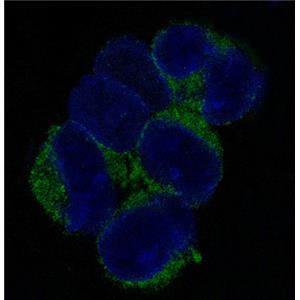 VCAM1兔多抗,VCAM1 Rabbit Polyclonal Antibody