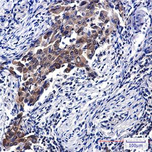 NSE兔多抗,NSE Rabbit Polyclonal Antibody
