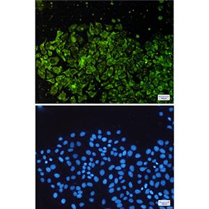 NSE兔多抗,NSE Rabbit Polyclonal Antibody