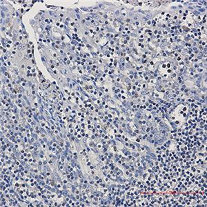 GRB2兔多抗,GRB2 Rabbit Polyclonal Antibody