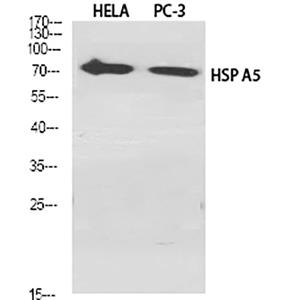 GRP78 BiP兔多抗,GRP78 BiP Rabbit Polyclonal Antibody
