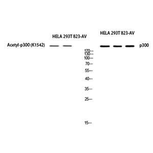 p300兔多抗,p300 Rabbit Polyclonal Antibody