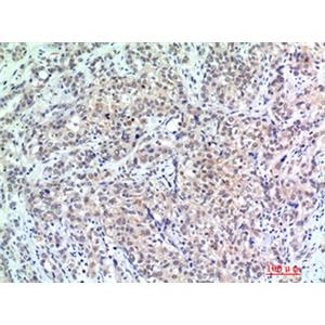 p300兔多抗,p300 Rabbit Polyclonal Antibody