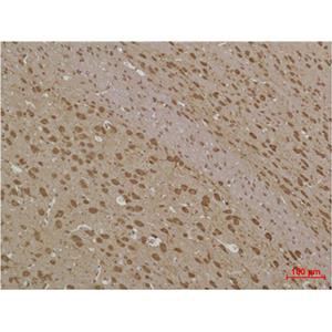 LC3B兔多抗,LC3B Rabbit Polyclonal Antibody