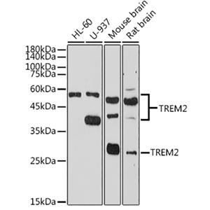 TREM2兔多抗,TREM2 Rabbit Polyclonal Antibody