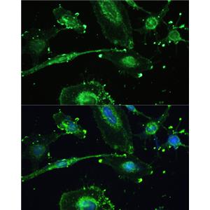 TREM2兔多抗,TREM2 Rabbit Polyclonal Antibody