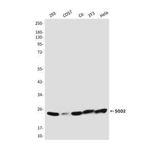 SOD2兔多抗,SOD2 Rabbit Polyclonal Antibody
