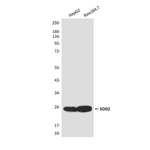 SOD2兔多抗,SOD2 Rabbit Polyclonal Antibody