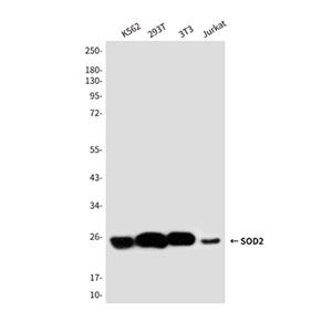 SOD2兔多抗,SOD2 Rabbit Polyclonal Antibody