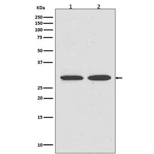 VDAC1兔多抗,VDAC1 Rabbit Polyclonal Antibody