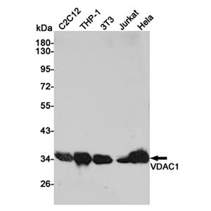 VDAC1兔多抗,VDAC1 Rabbit Polyclonal Antibody