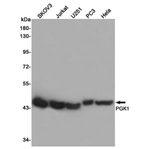 PGK1兔多抗,PGK1 Rabbit Polyclonal Antibody
