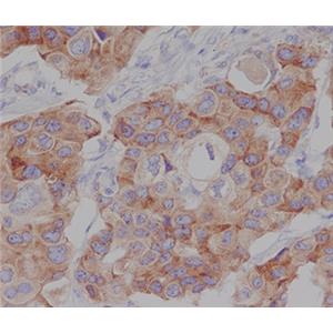 Phospho-mTOR (Ser2448)兔多抗,Phospho-mTOR (Ser2448) Rabbit Polyclonal Antibody