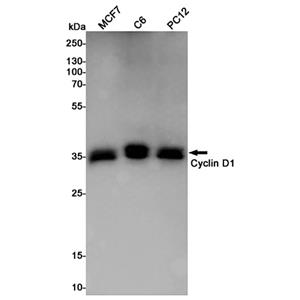 Cyclin D1兔多抗,Cyclin D1 Rabbit Polyclonal Antibody
