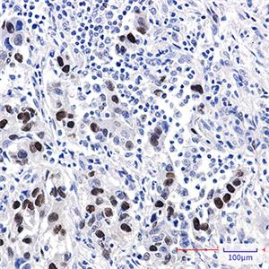 Cyclin D1兔多抗,Cyclin D1 Rabbit Polyclonal Antibody