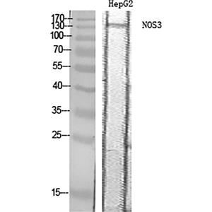 eNOS兔多抗,eNOS Rabbit Polyclonal Antibody