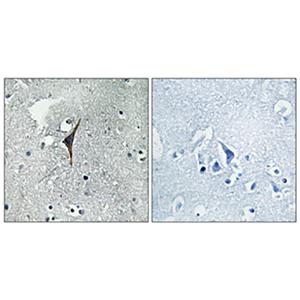 eNOS兔多抗,eNOS Rabbit Polyclonal Antibody
