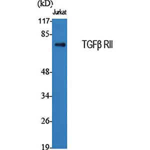 TGF beta Receptor II兔多抗,TGF beta Receptor II Rabbit Polyclonal Antibody