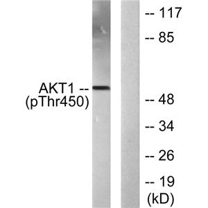 Akt1 (phospho Thr450)兔多抗,Akt1 (phospho Thr450) Rabbit Polyclonal Antibody