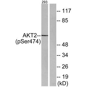 Akt2 (phospho Ser474)兔多抗,Akt2 (phospho Ser474) Rabbit Polyclonal Antibody