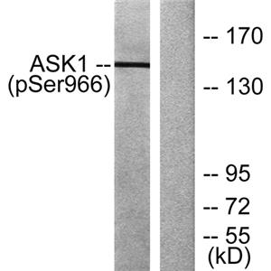 ASK 1 (phospho Ser966)兔多抗,ASK 1 (phospho Ser966) Rabbit Polyclonal Antibody