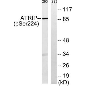 ATRIP (phospho Ser224)兔多抗,ATRIP (phospho Ser224) Rabbit Polyclonal Antibody