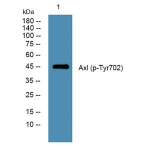 Axl (phospho-Tyr702) 兔多抗,Axl (phospho-Tyr702)  Rabbit Polyclonal Antibody