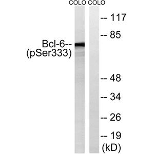 Bcl-6 (phospho Ser333)兔多抗,Bcl-6 (phospho Ser333) Rabbit Polyclonal Antibody