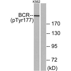 Bcr (phospho Tyr177)兔多抗,Bcr (phospho Tyr177) Rabbit Polyclonal Antibody
