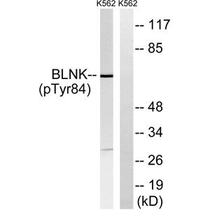 BLNK (phospho Tyr84)兔多抗,BLNK (phospho Tyr84) Rabbit Polyclonal Antibody