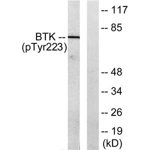 Btk (phospho Tyr223)兔多抗,Btk (phospho Tyr223) Rabbit Polyclonal Antibody