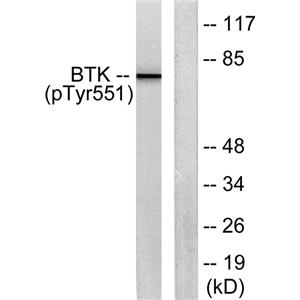 Btk (phospho Tyr551)兔多抗,Btk (phospho Tyr551) Rabbit Polyclonal Antibody
