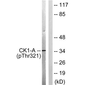 Casein Kinase Iα (phospho Tyr321)兔多抗,Casein Kinase Iα (phospho Tyr321) Rabbit Polyclonal Antibody