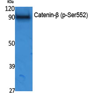 Catenin-β (phospho Ser552)兔多抗,Catenin-β (phospho Ser552) Rabbit Polyclonal Antibody