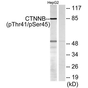 Catenin-β (phospho Thr41/S45)兔多抗,Catenin-β (phospho Thr41/S45) Rabbit Polyclonal Antibody