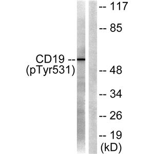 CD19 (phospho Tyr531)兔多抗,CD19 (phospho Tyr531) Rabbit Polyclonal Antibody