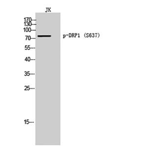 DRP1 (phospho Ser637)兔多抗,DRP1 (phospho Ser637) Rabbit Polyclonal Antibody
