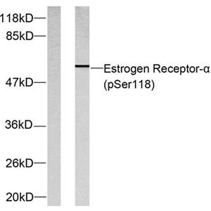 ERα (phospho Ser118)兔多抗,ERα (phospho Ser118) Rabbit Polyclonal Antibody