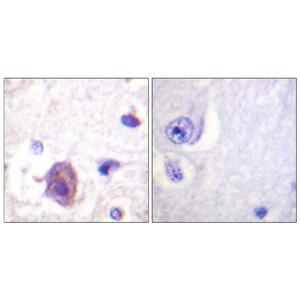 FAK (phospho Ser910)兔多抗,FAK (phospho Ser910) Rabbit Polyclonal Antibody