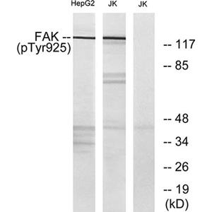 FAK (phospho Tyr925)兔多抗,FAK (phospho Tyr925) Rabbit Polyclonal Antibody