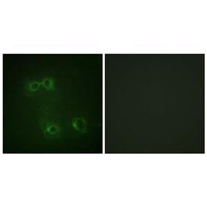 FAS (phospho Tyr291)兔多抗,FAS (phospho Tyr291) Rabbit Polyclonal Antibody