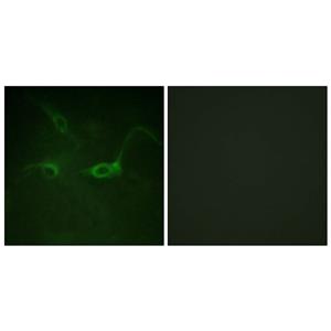 Flg (phospho Tyr654)兔多抗,Flg (phospho Tyr654) Rabbit Polyclonal Antibody