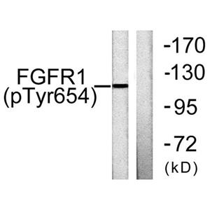 Flg (phospho Tyr654)兔多抗,Flg (phospho Tyr654) Rabbit Polyclonal Antibody