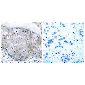 Flk-1 (phospho Tyr951)兔多抗,Flk-1 (phospho Tyr951) Rabbit Polyclonal Antibody