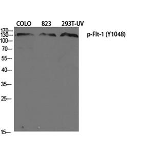 Flt-1 (phospho Tyr1048)兔多抗,Flt-1 (phospho Tyr1048) Rabbit Polyclonal Antibody