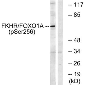 FoxO1 (phospho Ser256)兔多抗,FoxO1 (phospho Ser256) Rabbit Polyclonal Antibody