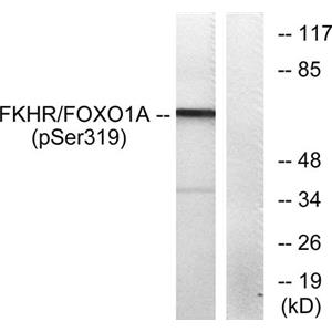 FoxO1 (phospho Ser319)兔多抗,FoxO1 (phospho Ser319) Rabbit Polyclonal Antibody