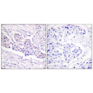 FoxO1A (phospho Ser329)兔多抗,FoxO1A (phospho Ser329) Rabbit Polyclonal Antibody