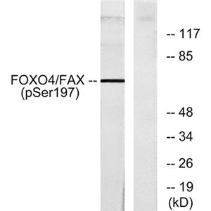 FoxO4 (phospho Ser197)兔多抗,FoxO4 (phospho Ser197) Rabbit Polyclonal Antibody