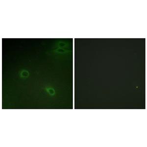 Fusin (phospho Ser339)兔多抗,Fusin (phospho Ser339) Rabbit Polyclonal Antibody
